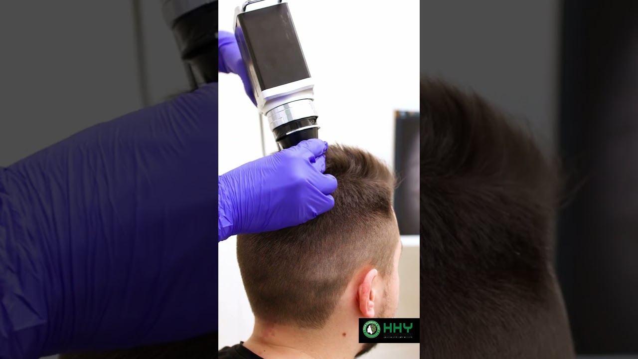 Best Aftercare After Hair Transplant | Laser Treatment Benefits