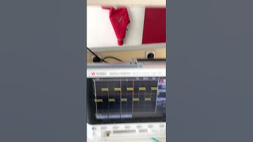 Variation de la vitesse d