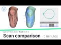 Comparaison de scans  vytruve solution