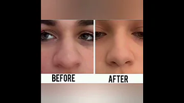 نتائج سبليمنال صادمة 