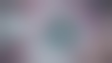 Ophthalmic surgery live 18+ Lukan Mishev