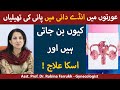 Anda dani ki rasoli ka ilaj  ovarian cyst signs and symptoms in urdu  ovarian cyst kaise thik kare