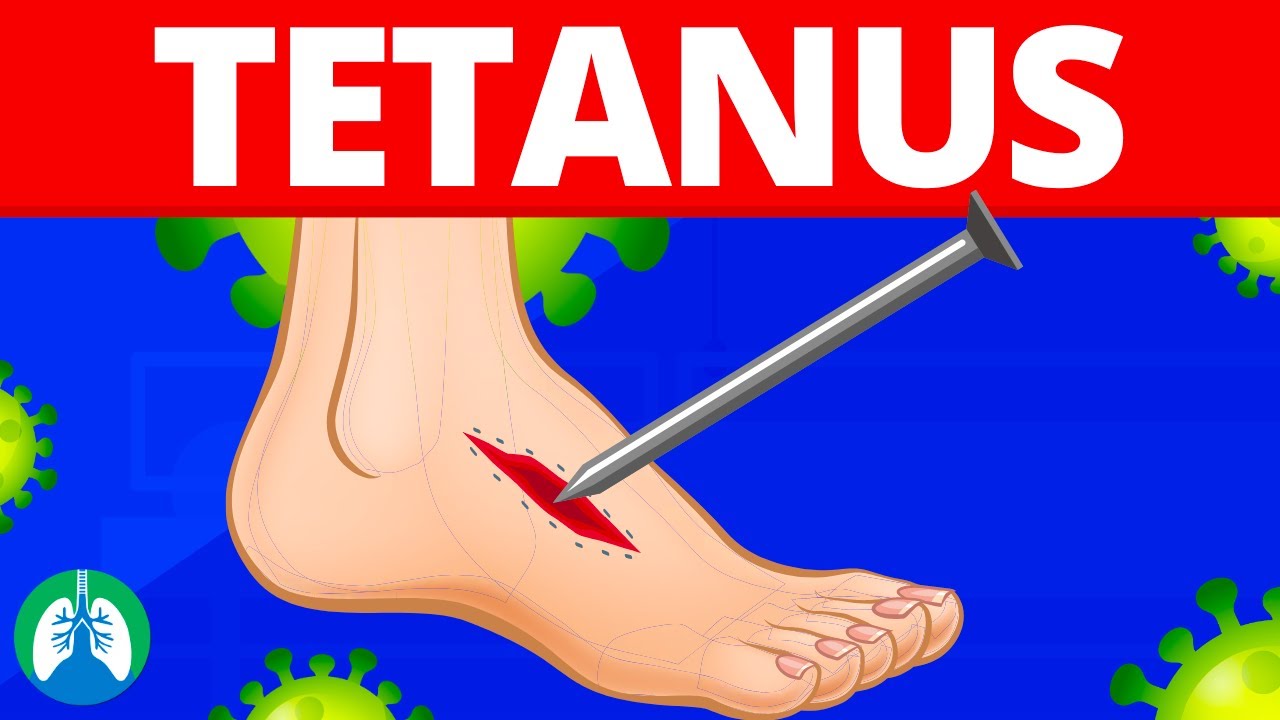 Tetanus Medical Definition Quick Explainer Video YouTube Tetanus Medical Definition Quick Explainer Video YouTube
