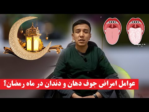 عوامل امراض جوف دهان و دندان در ماه رمضان 