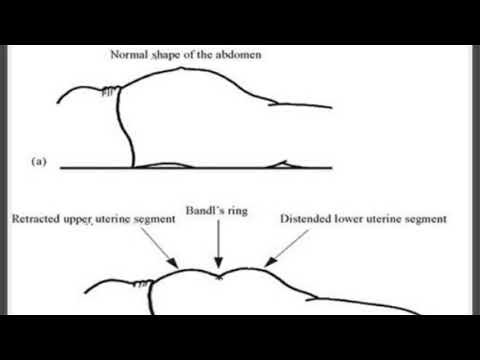 PRACTICAL 7 IDENTIFICATION AND MANAGEMENT OF OBSTETRICAL EMERGENCIES