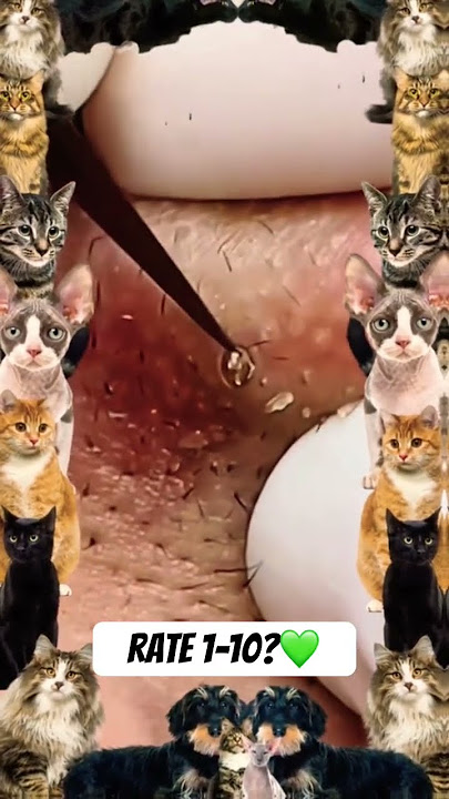 Wow! #shortsfeed #usa #shorts #short #pimple #pimples #pimplepopping #youtube #youtubeshorts