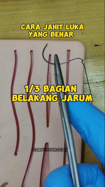 How to Suture in A Correct Way