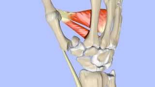 Fractures of the 1st Metacarpal Base:  Bennett's and Rolando's Fractures