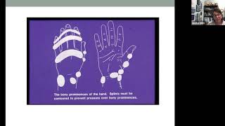 Splinting Webinar by OT ECHO Mentorship