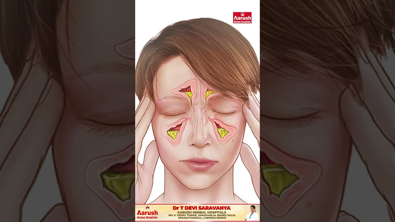 நாள்பட்ட சைனஸ் பிரச்சனைக்கு நிரந்தர தீர்வு ! | Siddha Dr.T.Devi Saravanya | Aarush Herbal Hospitals