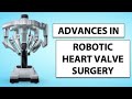 Patient webinar advances in robotic heart valve surgery