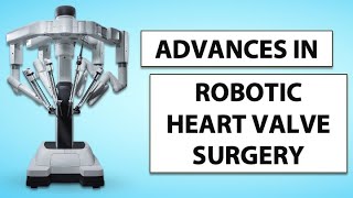 Patient Webinar: Advances in Robotic Heart Valve Surgery