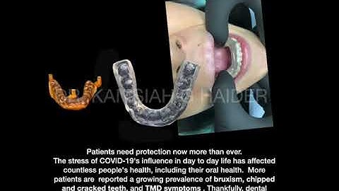 Dental Splint