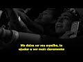 Alessia Cara - Scars To Your Beautiful (Legendado)