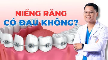 Giải Đáp Thắc Mắc: Niềng Răng Có Thực Sự Đau Như Lời Đồn? |Dr Cường Official