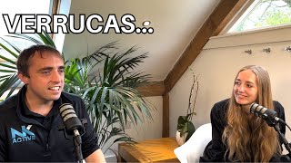 What is the best verruca treatment? | Is it Swift verruca treatment? | podiatry podcasts
