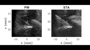 Comparison of Needle Tracking with Synthetic Aperture and Plane wave transmits