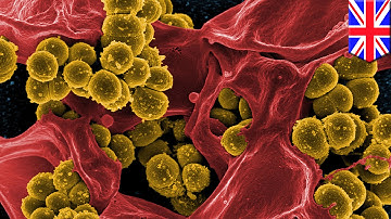 The end of superbugs? Medieval remedy kills up to 90 percent of MRSA bacteria in test