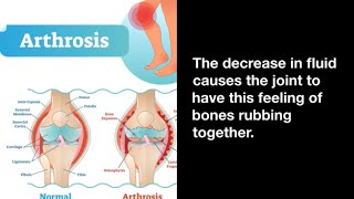 Chronic Knee Pain Inflammation &amp; Synovial Fluid Feedback Loop
