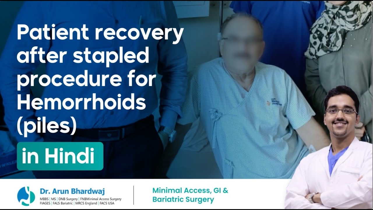 in-hindi-patient-recovery-after-stapled-procedure-for-haemorrhoids