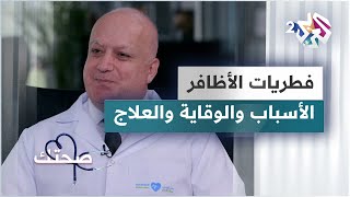 فطريات الأظافر.. الأسباب والوقاية والعلاج | دليل شامل