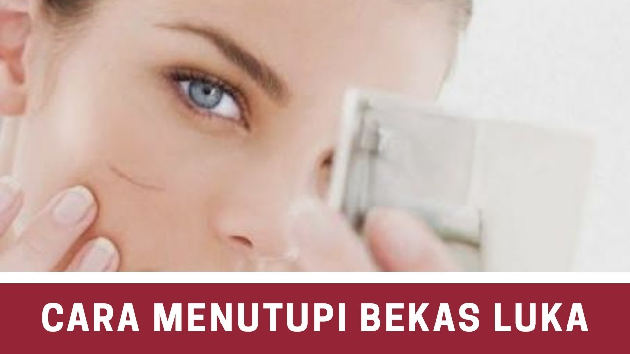 Cara Menutupi Bekas Luka Yang Mengganggu - YouTube