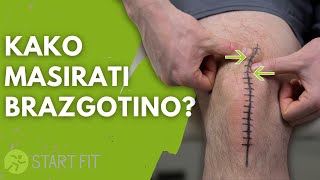 Kako Masirati Brazgotino Po Operaciji Kolena - Menjava Kolena Tep