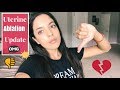 Uterine Ablation Update (Fail)