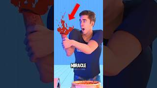 Limbs Reattached After Accidents ‼️😱 #Survival #Miracle