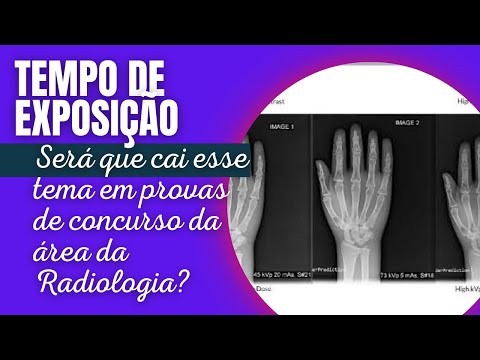 Vídeo: O que é contraste e densidade em radiografia?