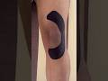 Taping for Patella Dislocation❤️ #kinesiotape #patelladislocation #massage #physio #sportsrehab