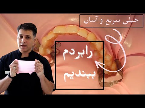 تصویری: چگونه دیاستما را ببندیم؟