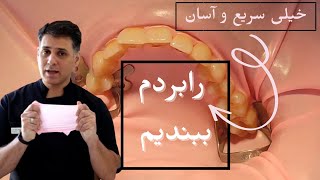 آسانترین و سریعترین روش بستن رابردم برای ایزولاسیون یک کوادران در درمانهای ترمیمی و کامپوزیت screenshot 1