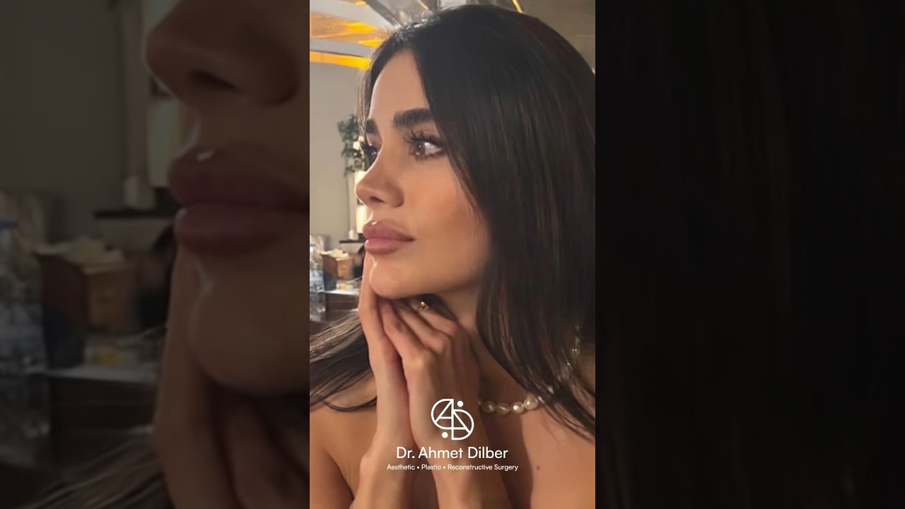 Rhinoplasty Turkey 👃🏻 Dr. Ahmet Dilber 