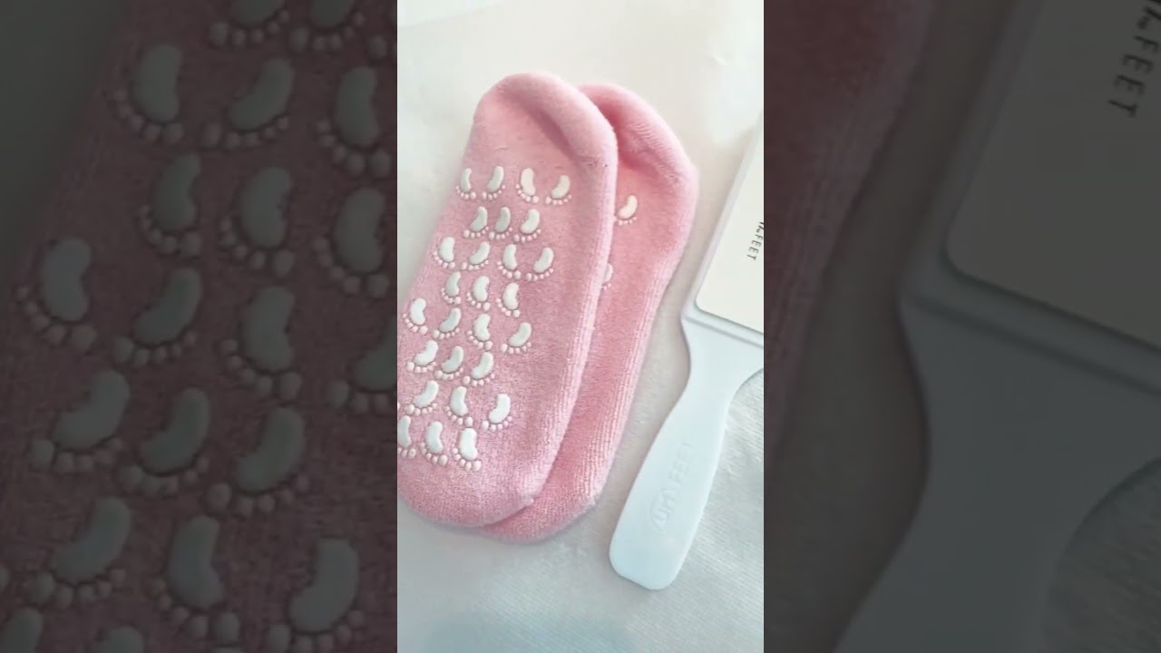 Yumi callus treatment by @marjorie_pbb