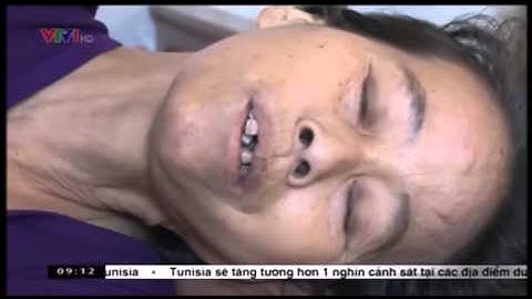 Asen  trong nguồn nước - 10 ngôi làng ung thư có nguồn nước ô nhiễm nhất cả nước