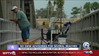 Health warning issued for Martin, Indian River County beaches because of bacteria