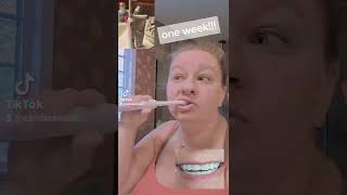 Natural Whitening Toothpaste