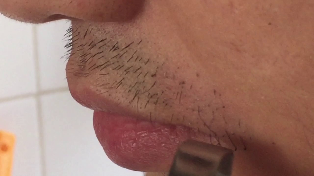 Plucking Chin Hair Vs Shaving