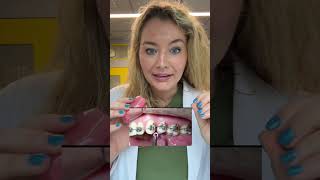 A Wire Doesnt Need To Be Changed At Every Appt Trust The Orthodontists Judgement