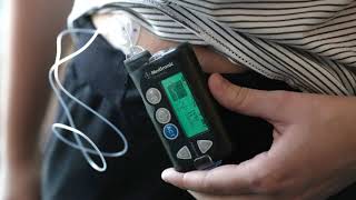 FDA approves new closed-loop insulin delivery system for people with Type 1 diabetes screenshot 5