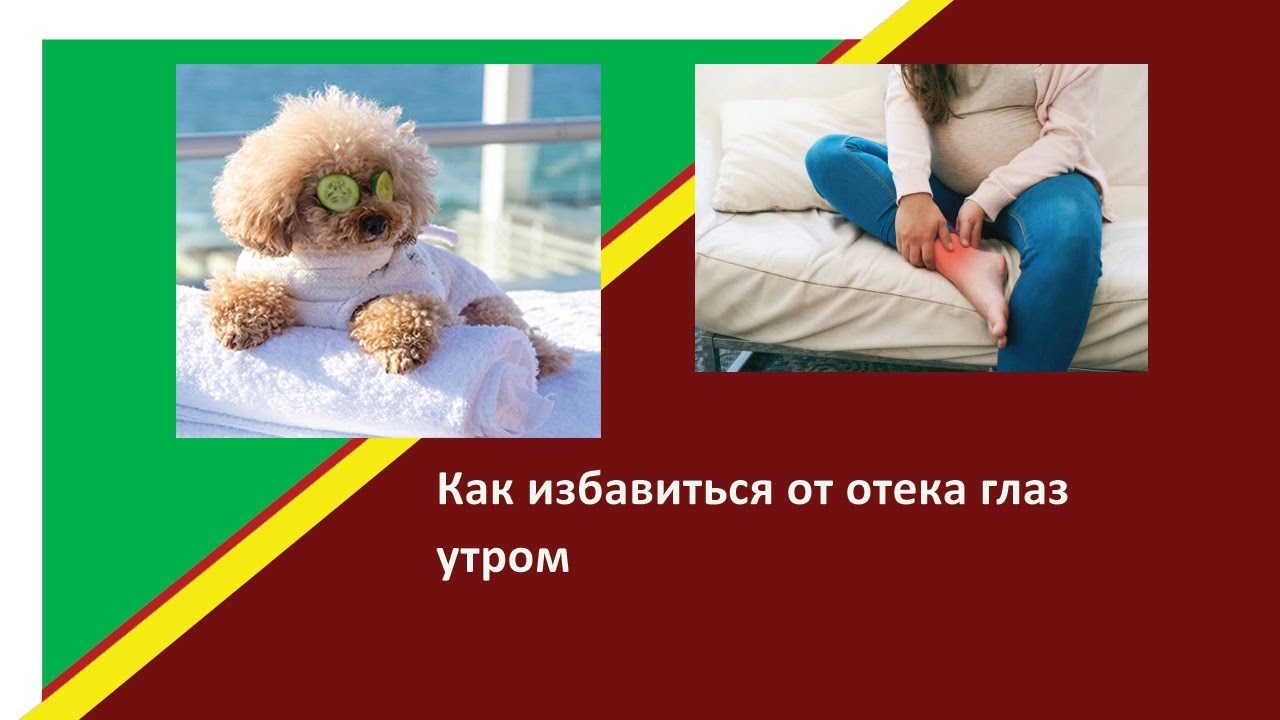 Утренние отеки лица причины и лечение