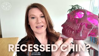 Correcting a Recessed Chin: Sliding Genioplasty vs Chin Implant