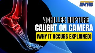 Achilles Rupture Caught on Camera (Why It Occurs Explained)
