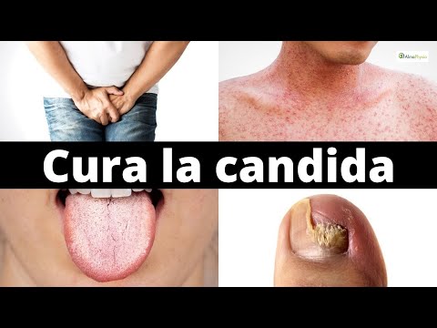 Video: Perché prendi la candida albicans?