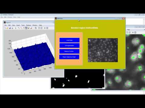 Seeded Region Growing Matlab Code 3D Projects