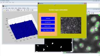 Celebrity Seeded Region Growing Matlab Code 3D Projects Wealth