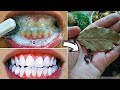 Secret that dentists dont want you to know remove tartar and teeth whitening in just 2 minutes