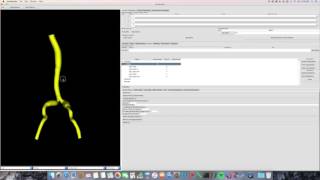Displaying a PolyData Model Net Worth