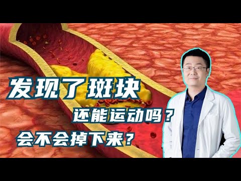 发现了颈动脉斑块，还能做运动吗？斑块会掉下来吗？听医生讲！